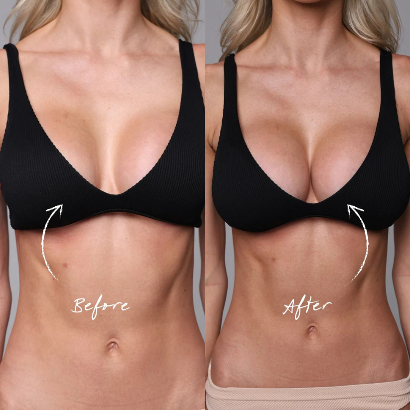 Untamed™ Sticky Inserts - Instant Boost Non-Adhesive Nip Covers